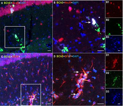 Enhanced Contextual Fear Memory and Elevated Astroglial Glutamate Synthase Activity in Hippocampal CA1 BChE shRNA Knockdown Mice